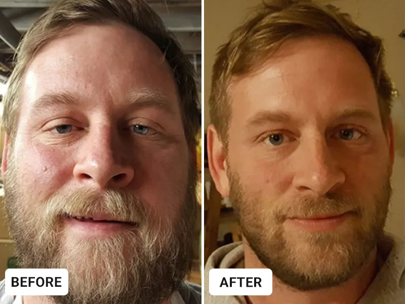 Before image for James, 53